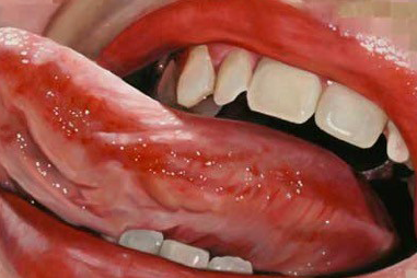 painting of a mouth